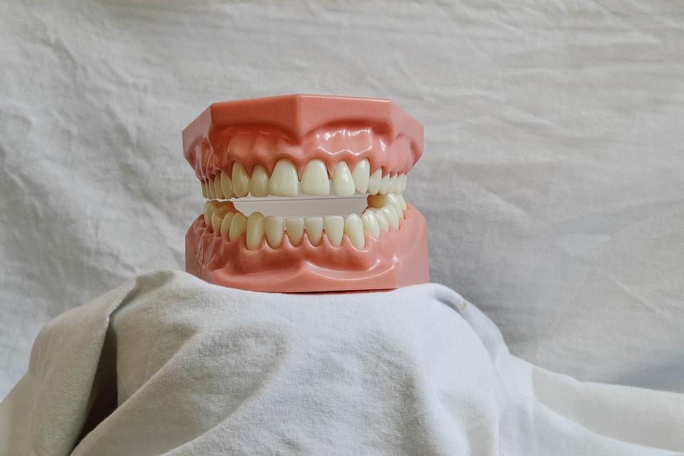 Partial Dentures