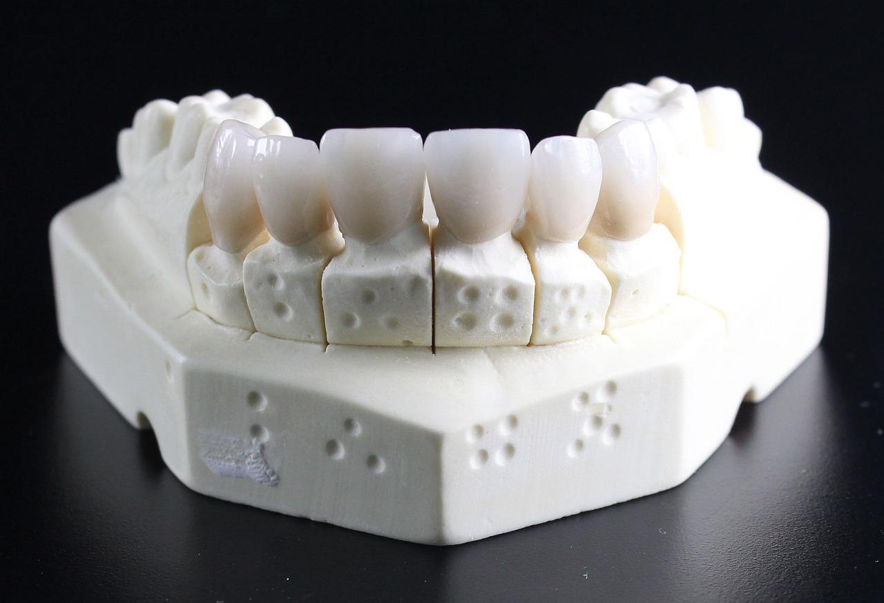 Partial Dentures